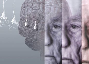 Demans (Bunama ) Nedir?