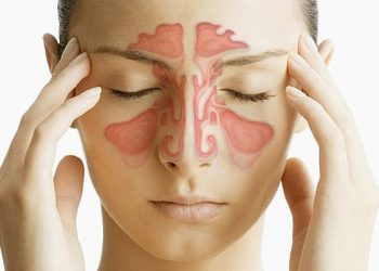 Sinüzit Belirtileri, Nedenleri ve Tedavisi