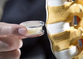 Bel Fıtığı Belirtileri ve Tedavisi