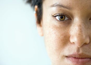 Cilt Benleri (Melanom) Tehlikeli Midir ?